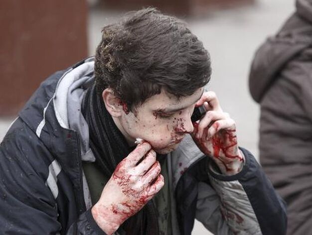 Un joven habla por telefono ensangrentado. / Reuters