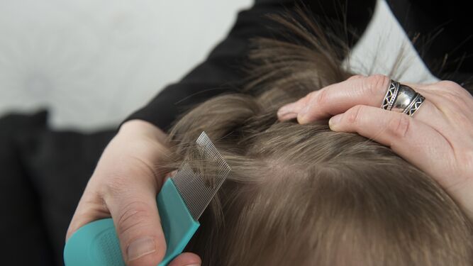 Los expertos recomiendan examinar el pelo con la lendrera y arrastrar los piojos mechón a mechón.