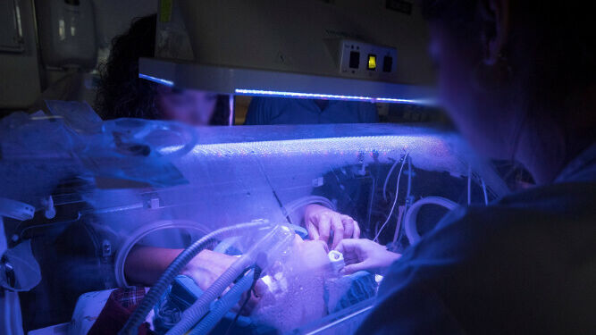 Dos enfermeras atienden a un bebé prematuro.