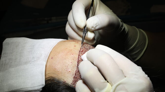 Fase de implantación en la clínica