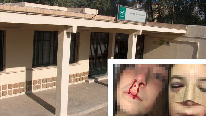 El instituto Álvar Núñez y en el recuadro las heridas que sufrió la niña agredida.