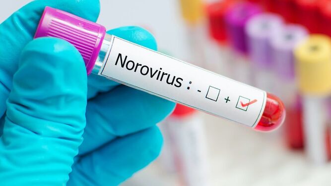 Norovirus: síntomas y tratamientos de un virus que afecta a los niños