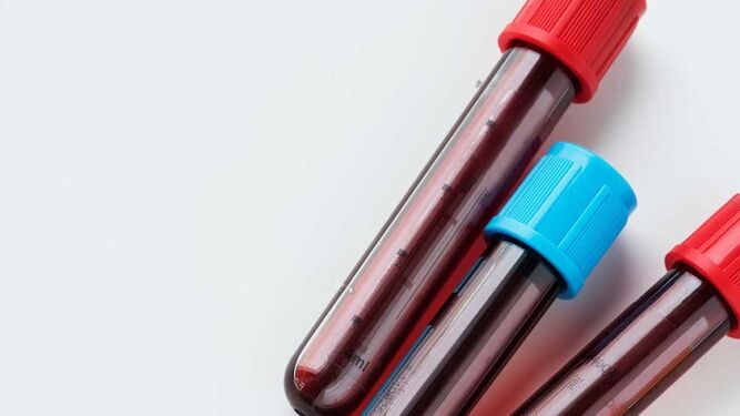 La nueva prueba de sangre que detecta más de 50 tipos de cáncer