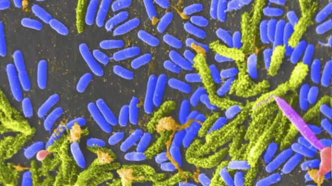 Bacteria 'vibrio' (Azul) puede causar Cólera