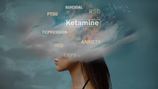 Ketamina como solución a la depresión: un nuevo estudio corrobora su  rápido efecto en la mitad de los casos