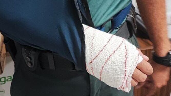Un guardia civil con lesiones en un brazo tras una agresión de este año en Chiclana.