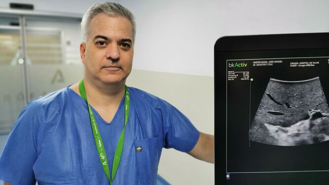 Pablo Parra Membrives, jefe del servicio de Cirugía General y Digestiva del Hospital Universitario de Valme de Sevilla.